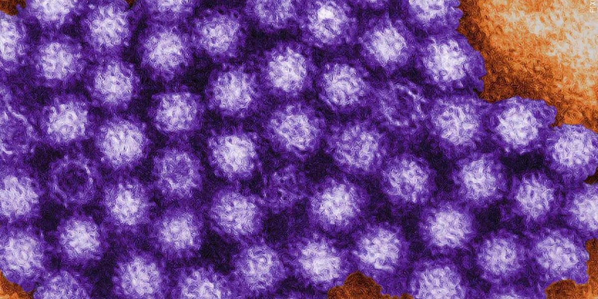 St Paul Elder Services In Kaukauna Currently Managing Norovirus St paul elder services in kaukauna currently managing norovirus