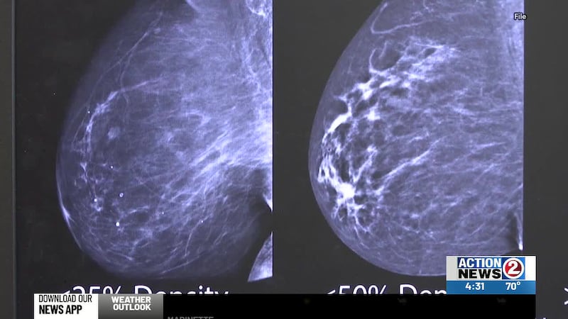 October is Breast Cancer Awareness Month, highlighting the importance of early detection and...